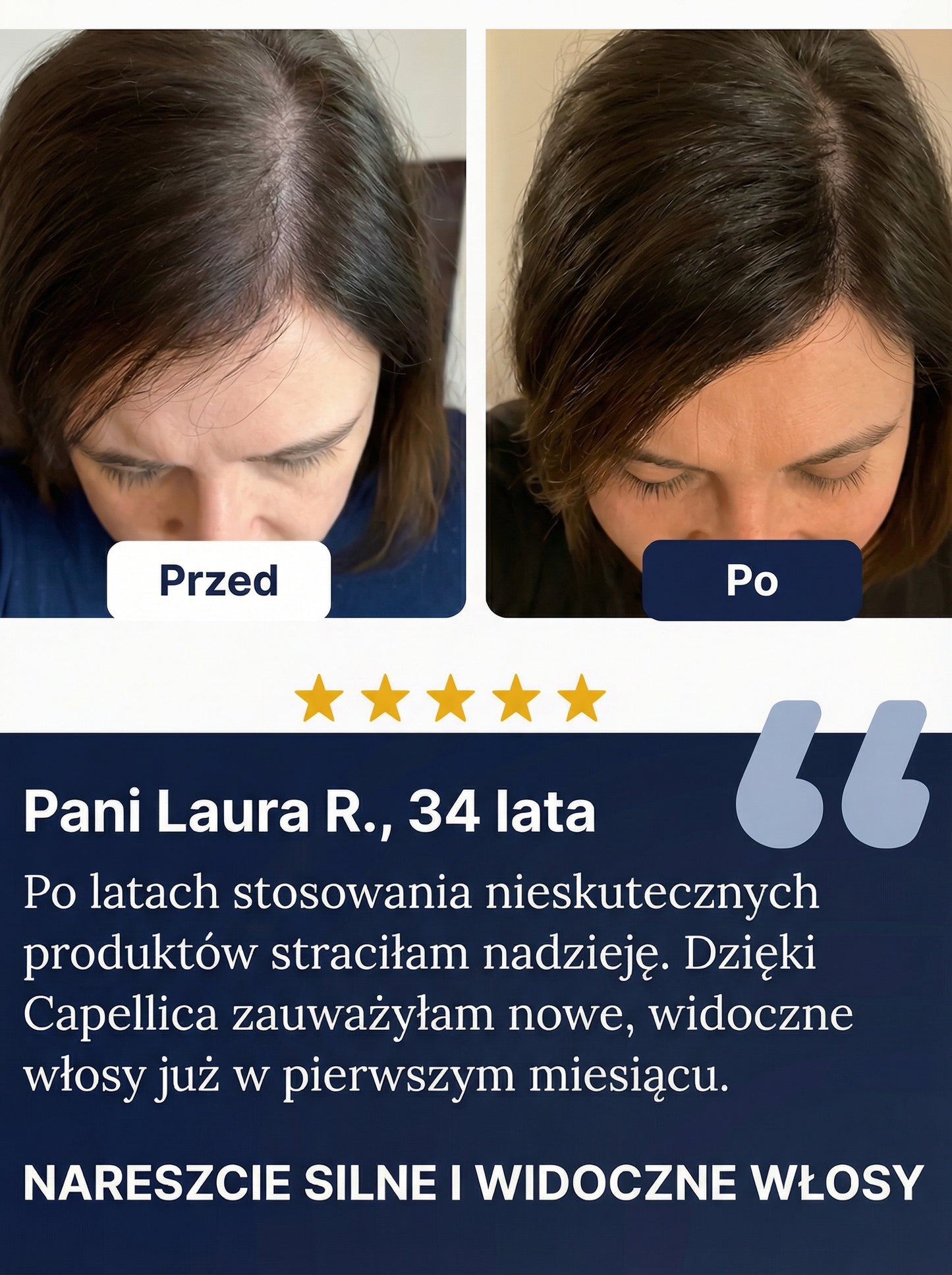 Capellica® Roll-On